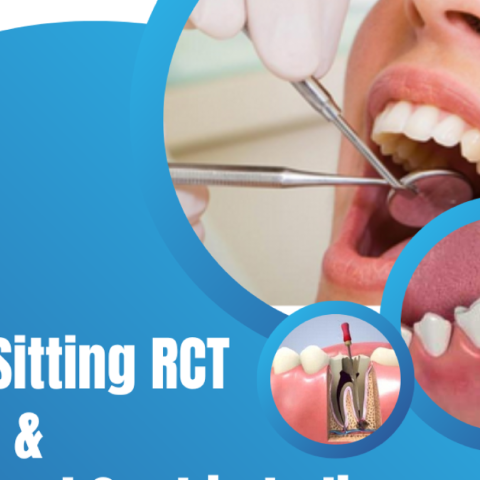An image illustrating a single-sitting root canal treatment, emphasizing efficiency and patient comfort.